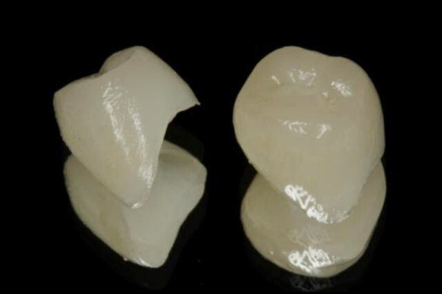 画像：e maxの臨床