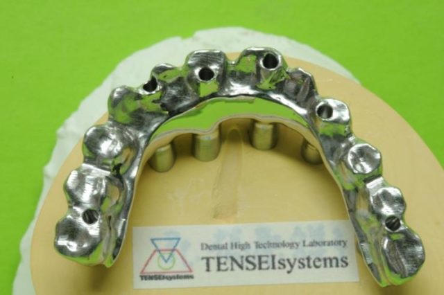 画像：アトランティススープラストラクチャーMB(Co-Cr)の臨床