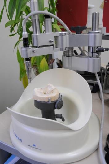 画像：ジルコニア カスタムアバットメントの臨床