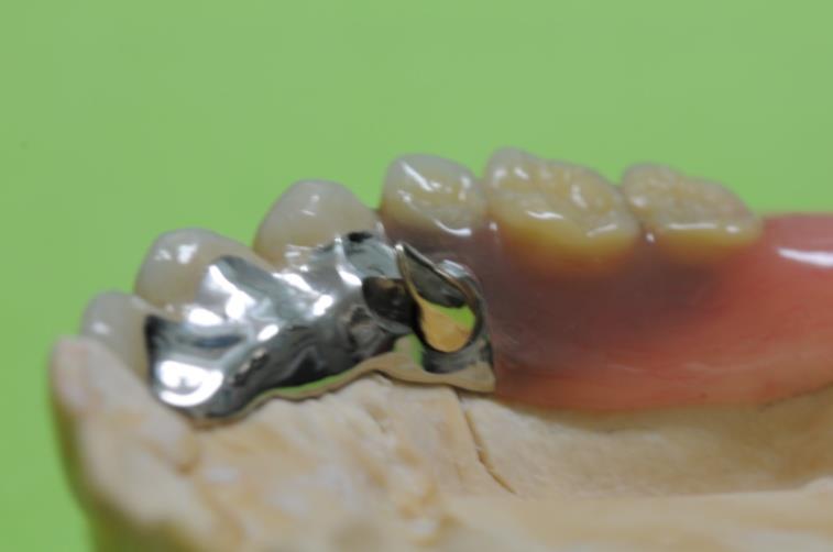 画像：ハンドメイド回転式リーゲル