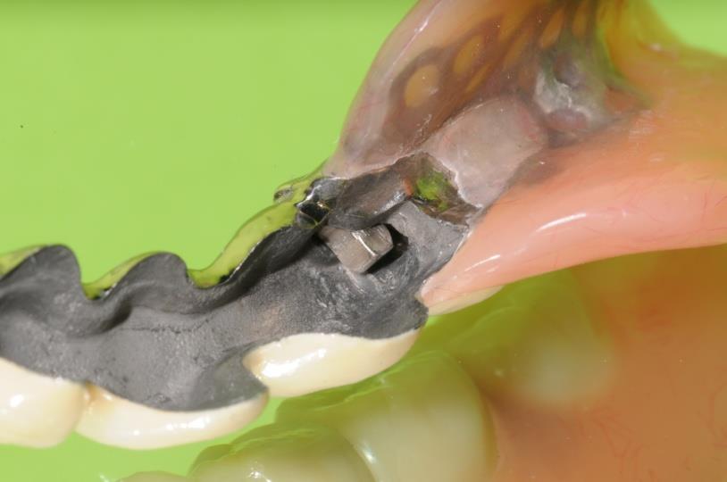 画像：ハンドメイドスライド式リーゲル